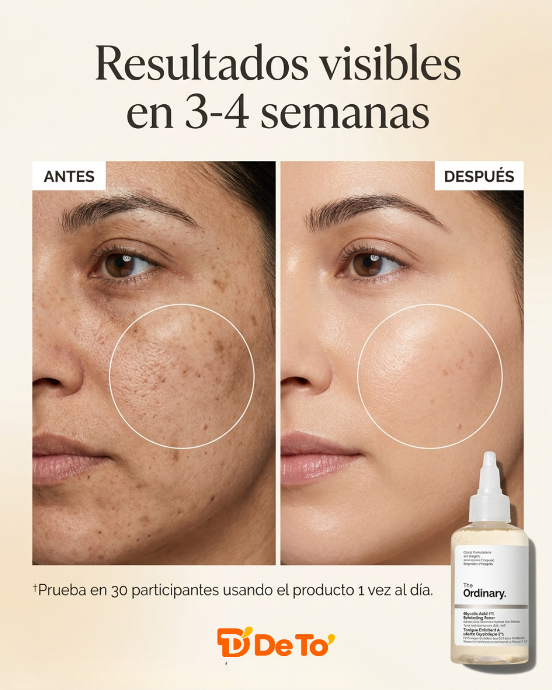 The Ordinary – Tónico exfoliante con ácido glicólico 7 % para una piel más suave y luminosa